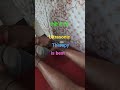 ऐड़ी में दर्द,,Heel pain  Heel spur for best ultrasonic therapy