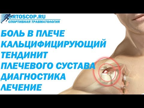 КАЛЬЦИФИЦИРУЮЩИЙ ТЕНДИНИТ ПЛЕЧЕВОГО СУСТАВА