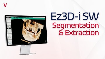 Ez3D-i SW | Segmentation & Extraction