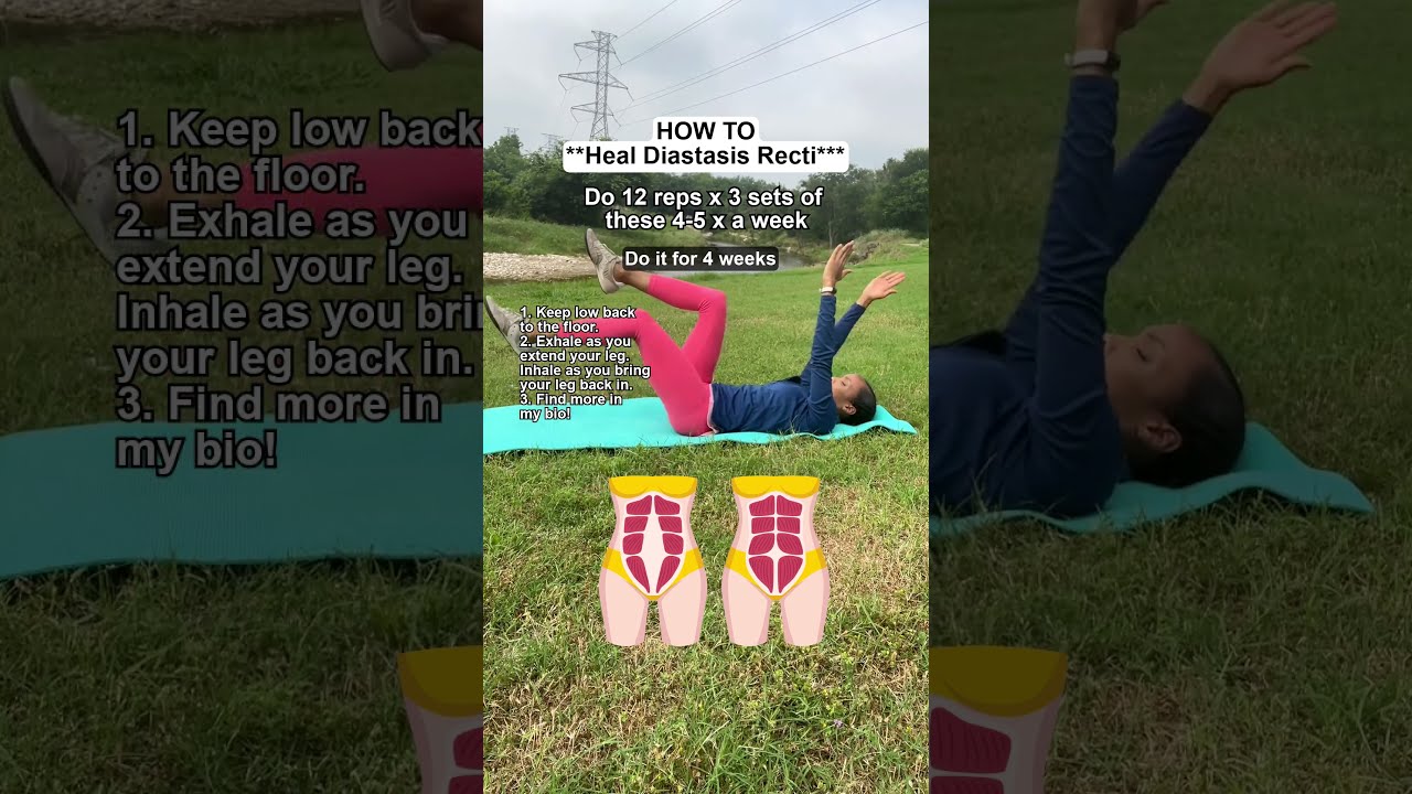 HEAL Your Diastasis Recti NATURALLY With These Exercises 
