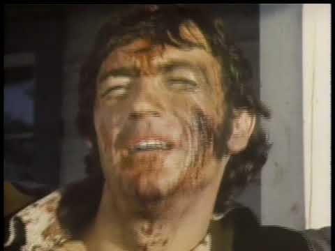 The Frontal Lobes and Behavior The Story of Phineas Gage