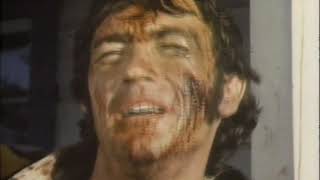The Frontal Lobes and Behavior The Story of Phineas Gage