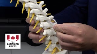 New implant helps regulate blood pressure for those with spinal cord injuries