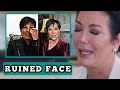 Kris Jenner devastated as new surgery ruins her face