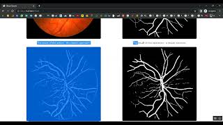 Information Multi Label Retinal Disease Classification Using Transformers News