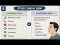 Cholinergic vs myasthenic crises -Easy explanation #neurology #fcps #education #exam #medicine