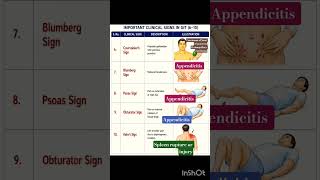 IMPORTANT CLINICAL SIGN IN GIT PART -2 #viral #youtubeshorts #medicaleducation #shortsfeed