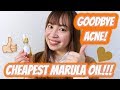 CHEAPEST MARULA OIL | IT CURED MY ACNE?!