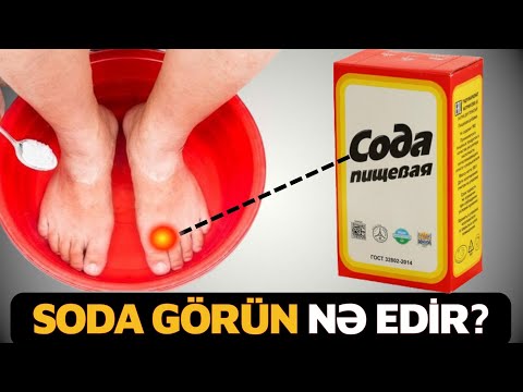 90% İnsan SODANIN İnsana Nələr Etdiyini Bilmir