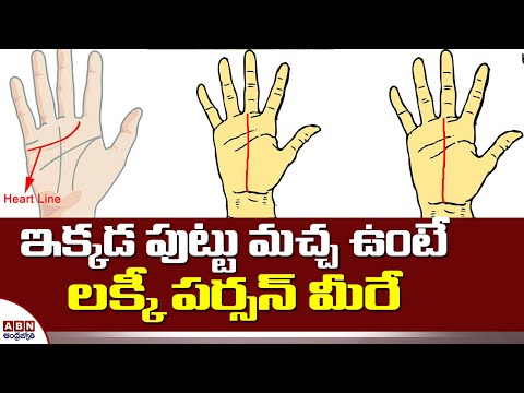 ఇక్కడ పుట్టు మచ్చ ఉంటే లక్కీ పర్సన్ మీరే | Does Palmistry Lines Affect Health? | Something Special