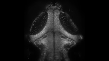 QBI lightsheet imaging larval zebrafish