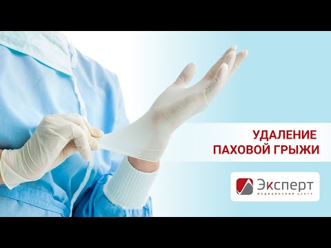 Операция по удалению паховой грыжи