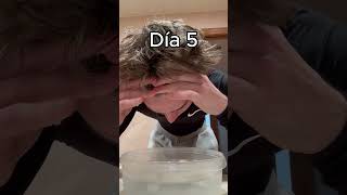 Sumergí Mi Cara En Agua Con Hielo Por 7 Días...