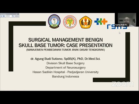 Surgical Management Benign Skull Base Tumor - dr  Agung Budi Sutiono, SpBS K, PhD,
