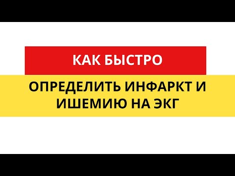 Инфаркт и ишемия миокарда. Миокардиальное повреждение. ЭКГ диагностика.#Shorts