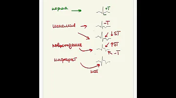 Инфаркт и ишемия миокарда. Миокардиальное повреждение. ЭКГ диагностика.#Shorts