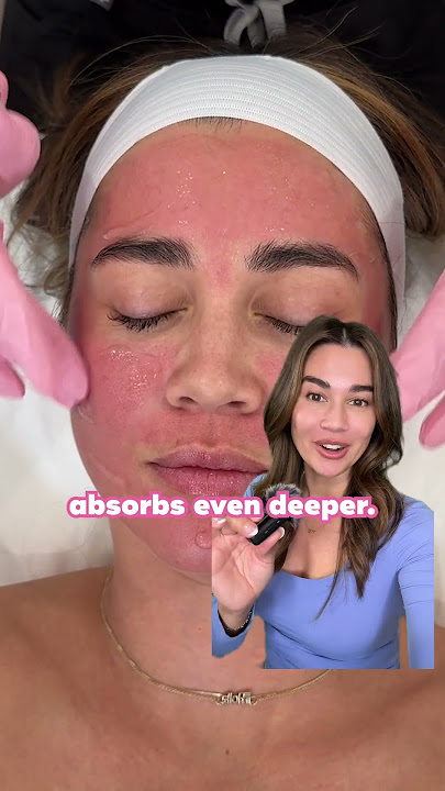 ✨The Salmon DNA Treatment For Glowing Skin✨