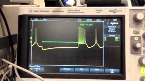 Hindmarsh Rose Model