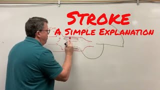 Stroke (Cerebrovascular Accident) A Simple Explanation