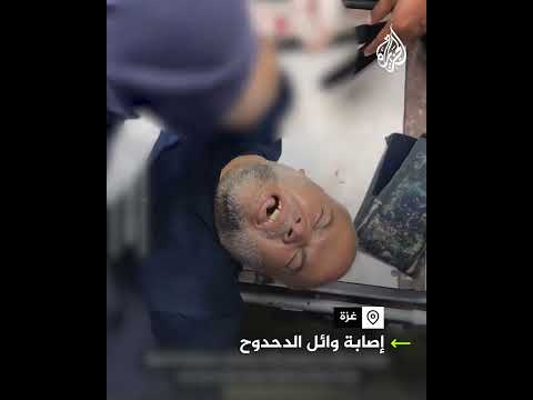 إصابة الزميل وائل الدحدوح مراسل قناة الجزيرة خلال تغطيته قصفا على خانيونس