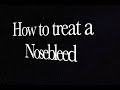WUD#1  How to Treat a Nosebleed