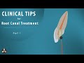 Root canal treatment  clinical tips  part 1