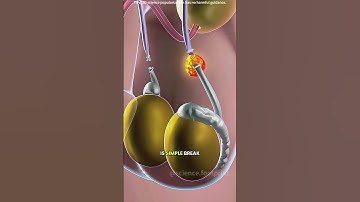Vasectomy procedure 3D animation #drone #theflash #space #automobile #scifi #science #3danimation