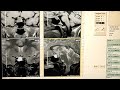 Pituitary Gland MRI scan procedure || open MRI (0.3 Tesla) system .