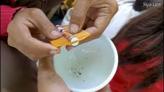 How remove million head lice from brown hair