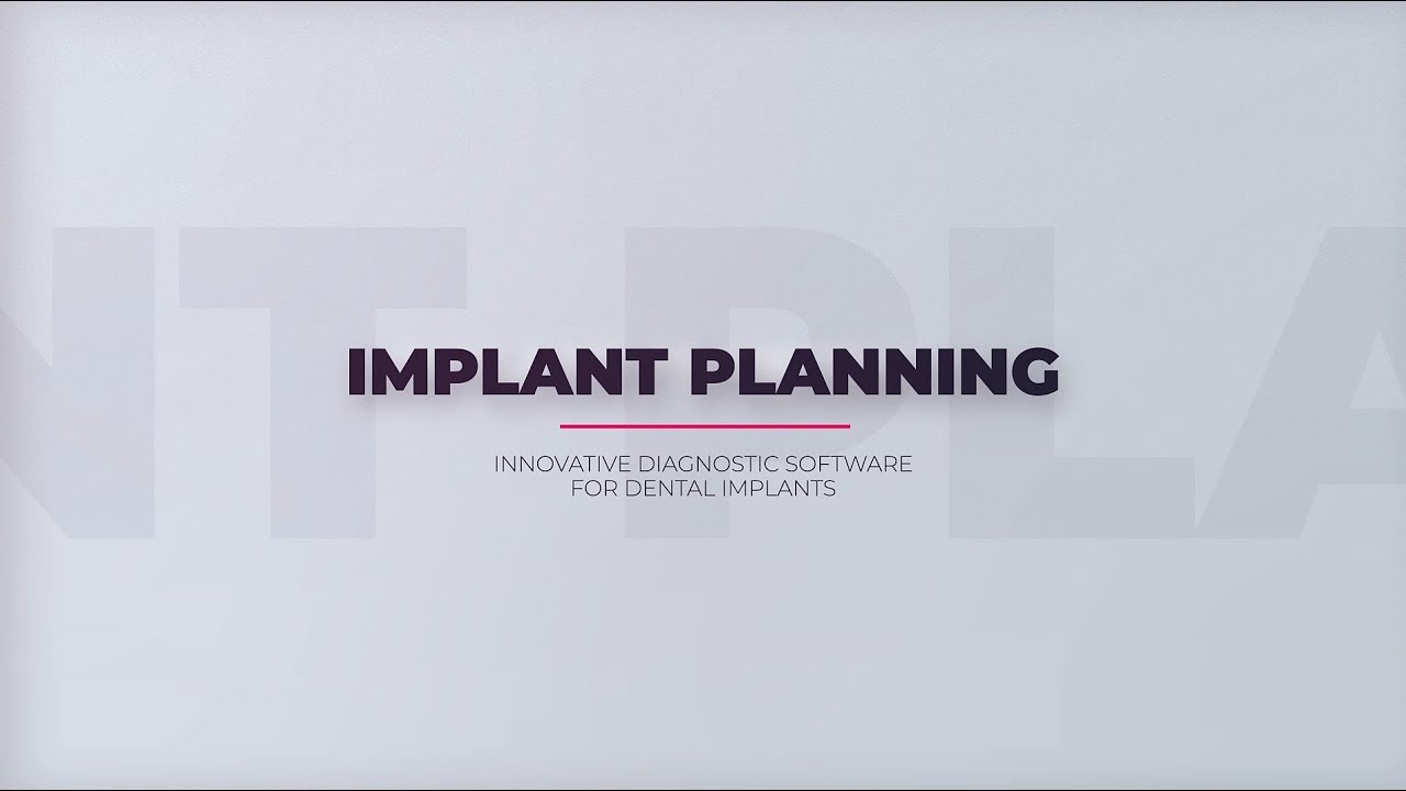 R2GATE Implant planning
