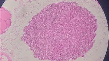 ÔN LẠI MÔ CÁC TUYẾN NỘI TIẾT - MODULE HỆ NỘI TIẾT