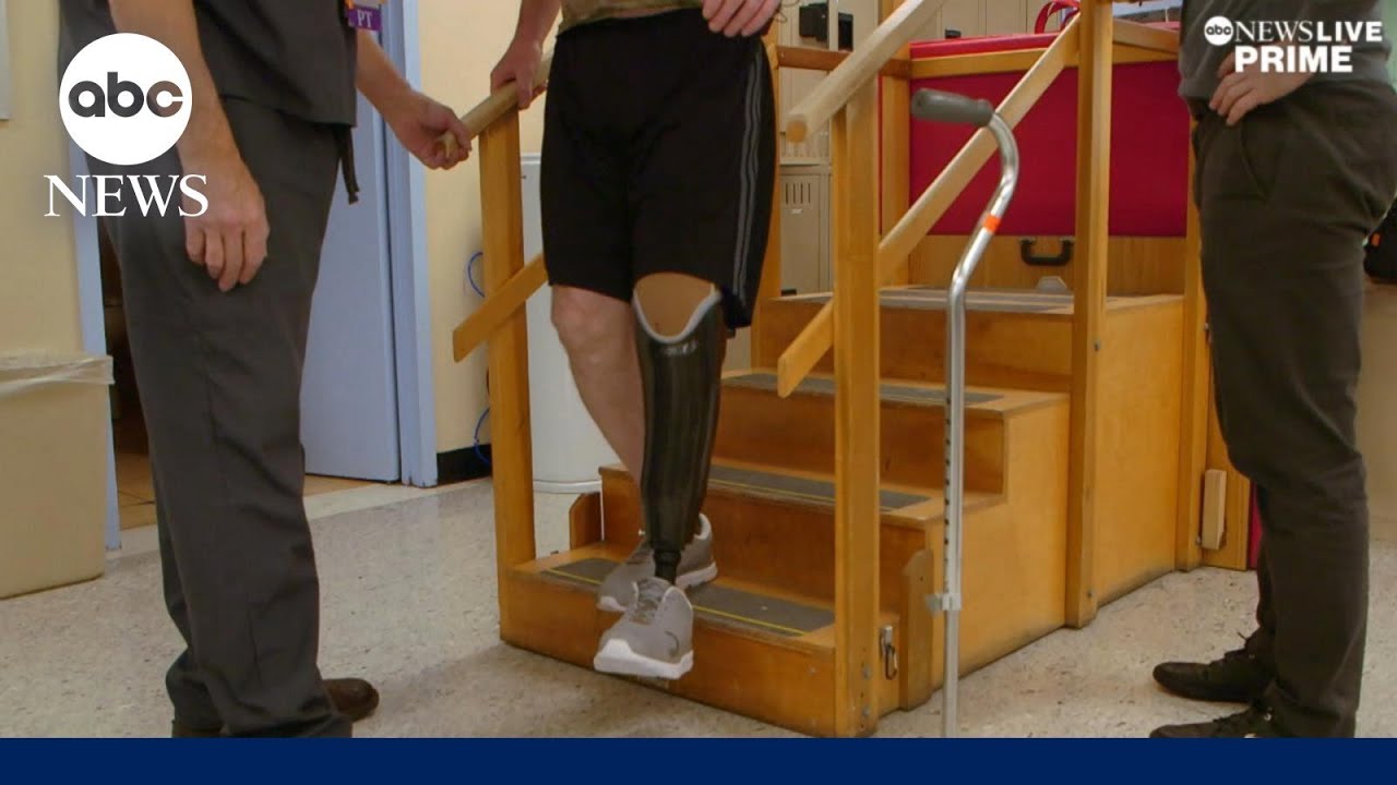 Good Samaritans outfit Ukrainian soldiers with prosthetics | ABCNL