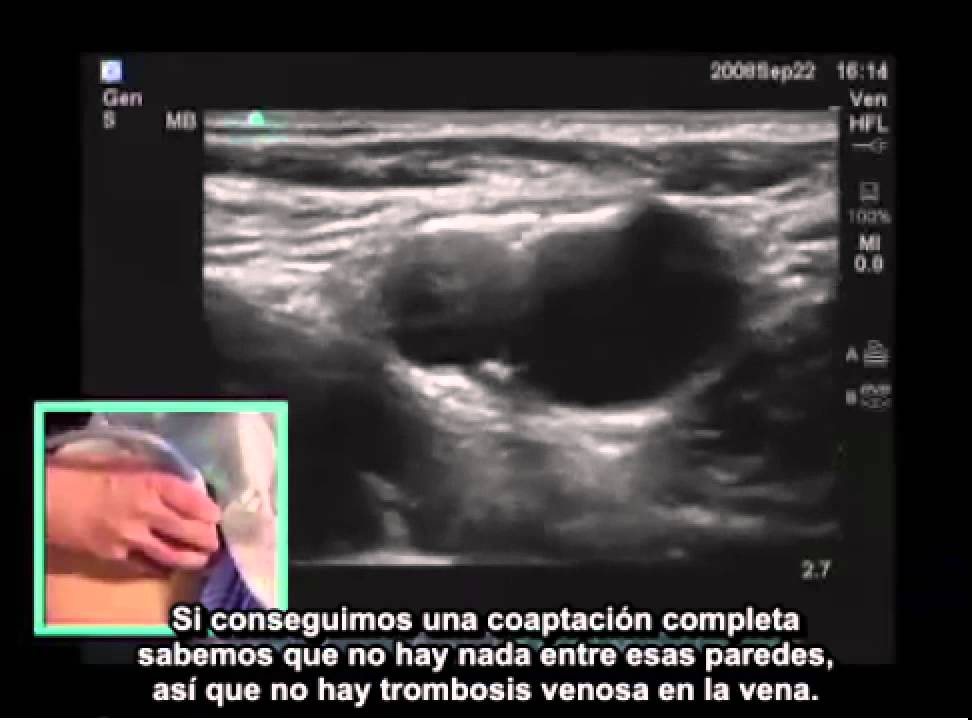 La cirugía vascular en simferopole