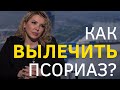 Как лечить псориаз! 18+