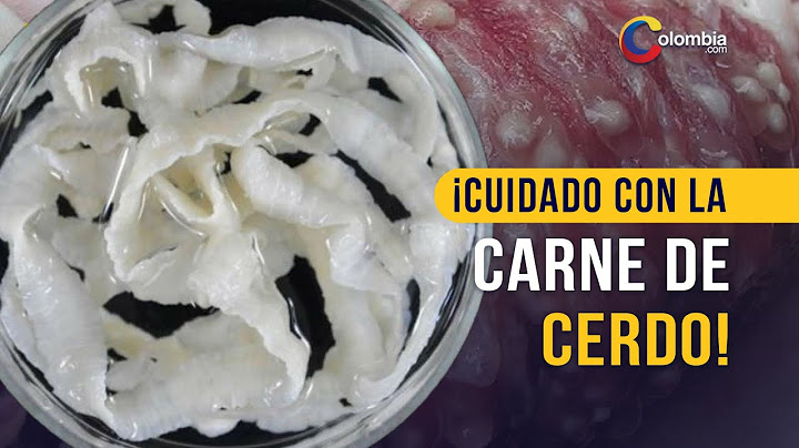 La enfermedad que se produce por comer carne de cerdo mal cocida