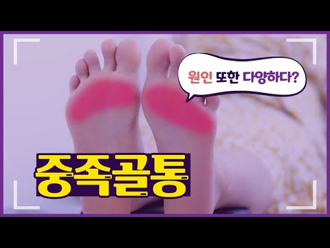 발바닥 앞쪽 통증의 원인, 중족골통! 원인 또한 다양하다?