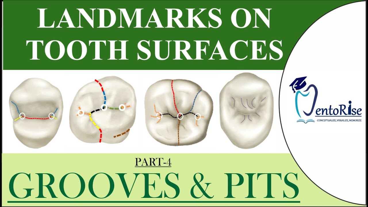 Landmarks on tooth surfaces |Part4| GROOVES | PITS | Terminology
