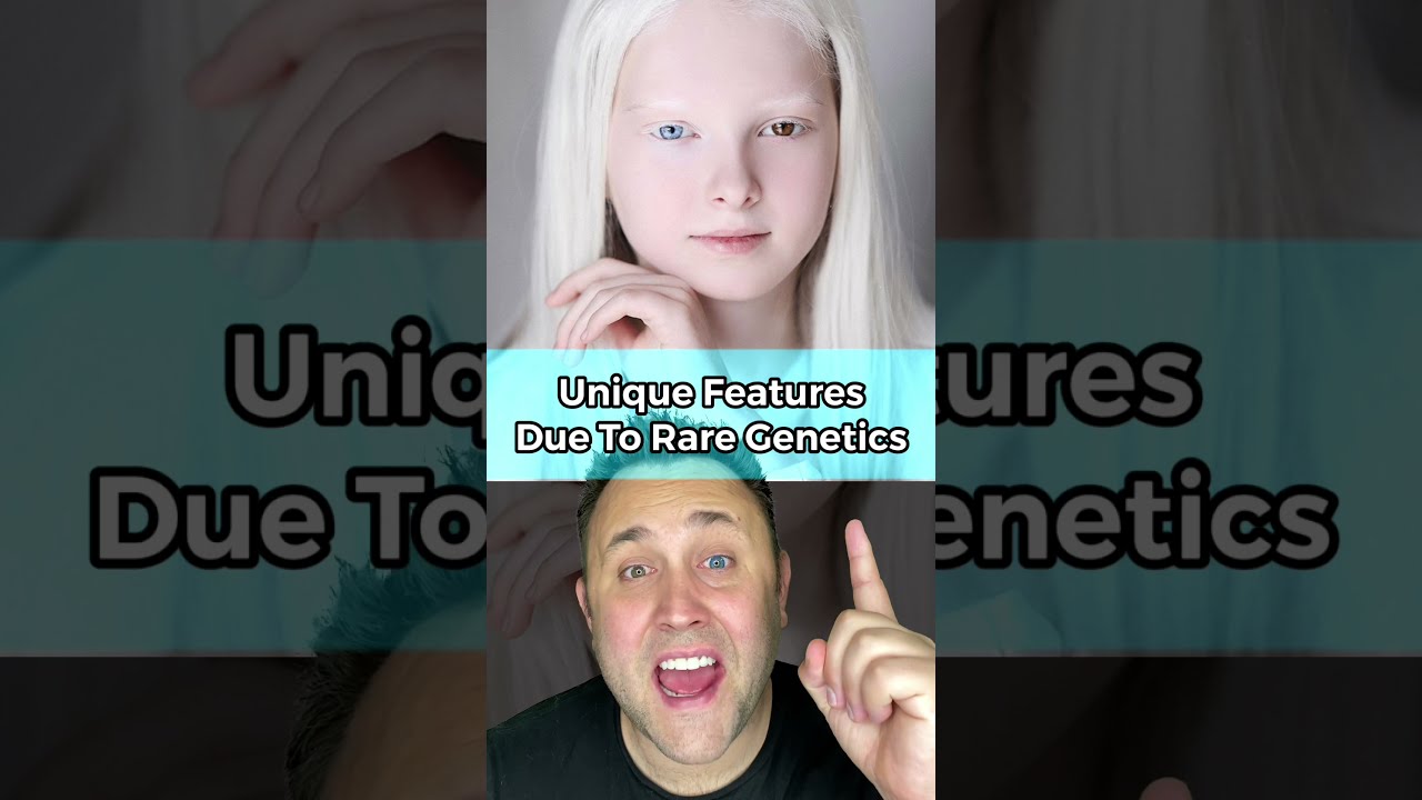 UNIQUE FEATURES DUE TO RARE GENETICS