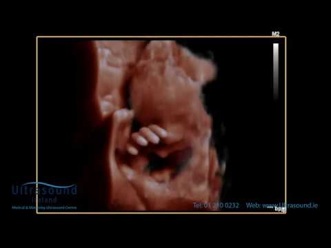 Scan of the Week: 28 week waving hello during our - YouTube