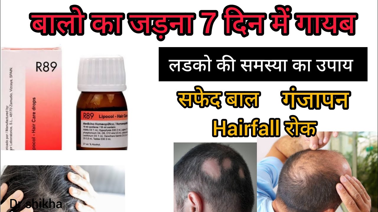 Hairfall Hair Regrowth Homoeopathic R89 Medicine In Hindi hairfall-hair-regrowth-homoeopathic-r89-medicine-in-hindi