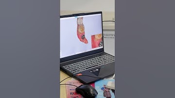 When Implants Meet Oral Scanners. #youtube