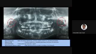 10 ANÁLISIS RADIOGRAFÍA PANORÁMICA