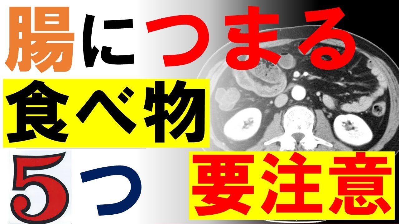 腸につまる食べ物５つ：外科医が腸閉塞の原因となる食品を解説