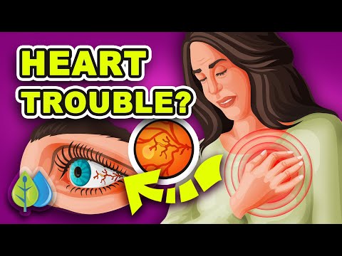 Top 3 Signs of Heart Disease Your Eyes REVEAL (&amp; 5 health problems)