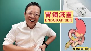 國際胃鏡減重新奇治療方法｜EndoBarrier 有效改善糖尿病？『北醫減重GURU王偉』