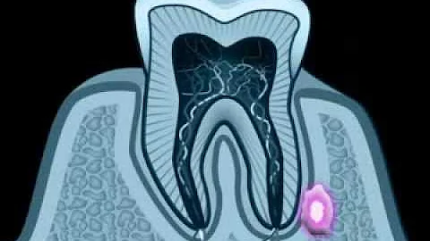 Jak poznám, že mám na vaječníku cystu?