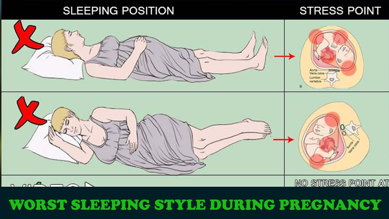 How To Sleep During Pregnancy Best Sleeping Position During Pregnancy Youtube