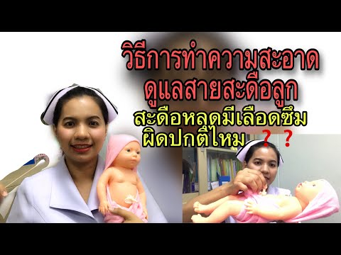 วีดีโอ: วิธีจัดการกับสายสะดือของทารกแรกเกิด