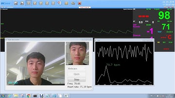 Heart rate measurement using camera