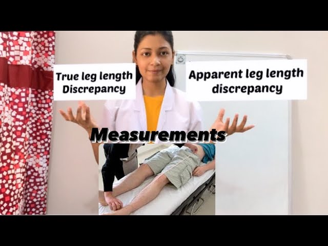 True leg length measurement 